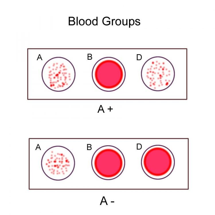 Blood types. Type a кровь. Blood group types. Blood group b. Type a кровь.