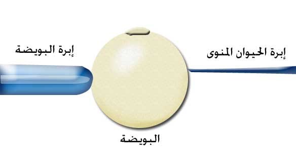 icsi1.jpg