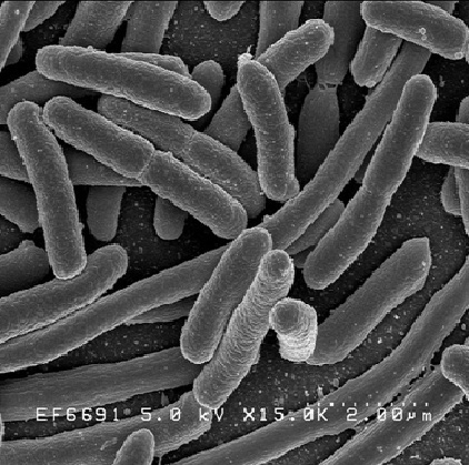 akhawat_islamway_1363964927__ecoli2.jpg
