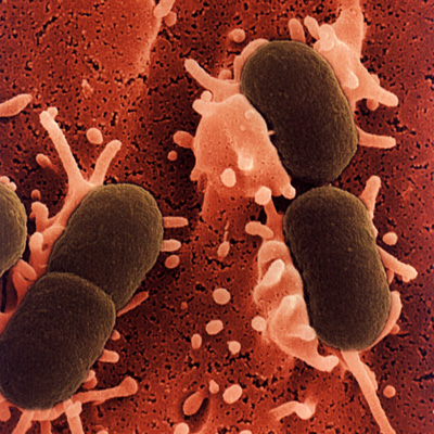akhawat_islamway_1363965634__escherichia-coli.jpg