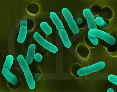 akhawat_islamway_1363966411__e_coli-dk.jpg