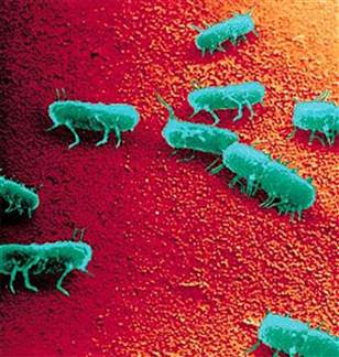 akhawat_islamway_1363967264__g-hlt-090127-salmonella-typhimurium-5pgrid-4x2.jpg