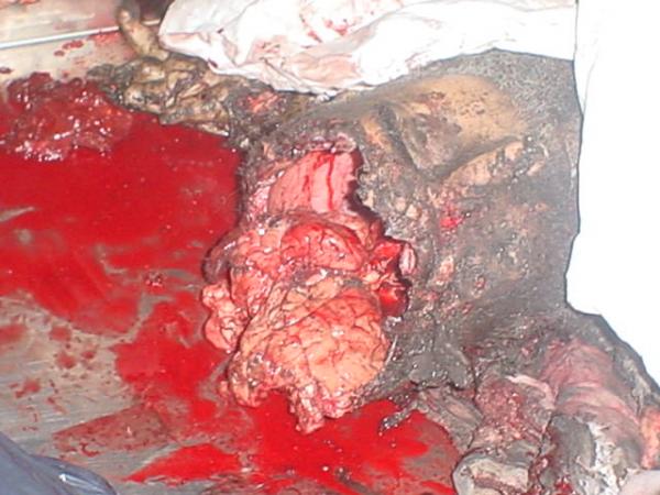 post-26134-1169066836_thumb.jpg